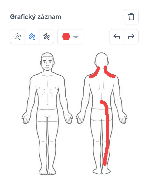 Náhled obrazovky grafického záznamu
